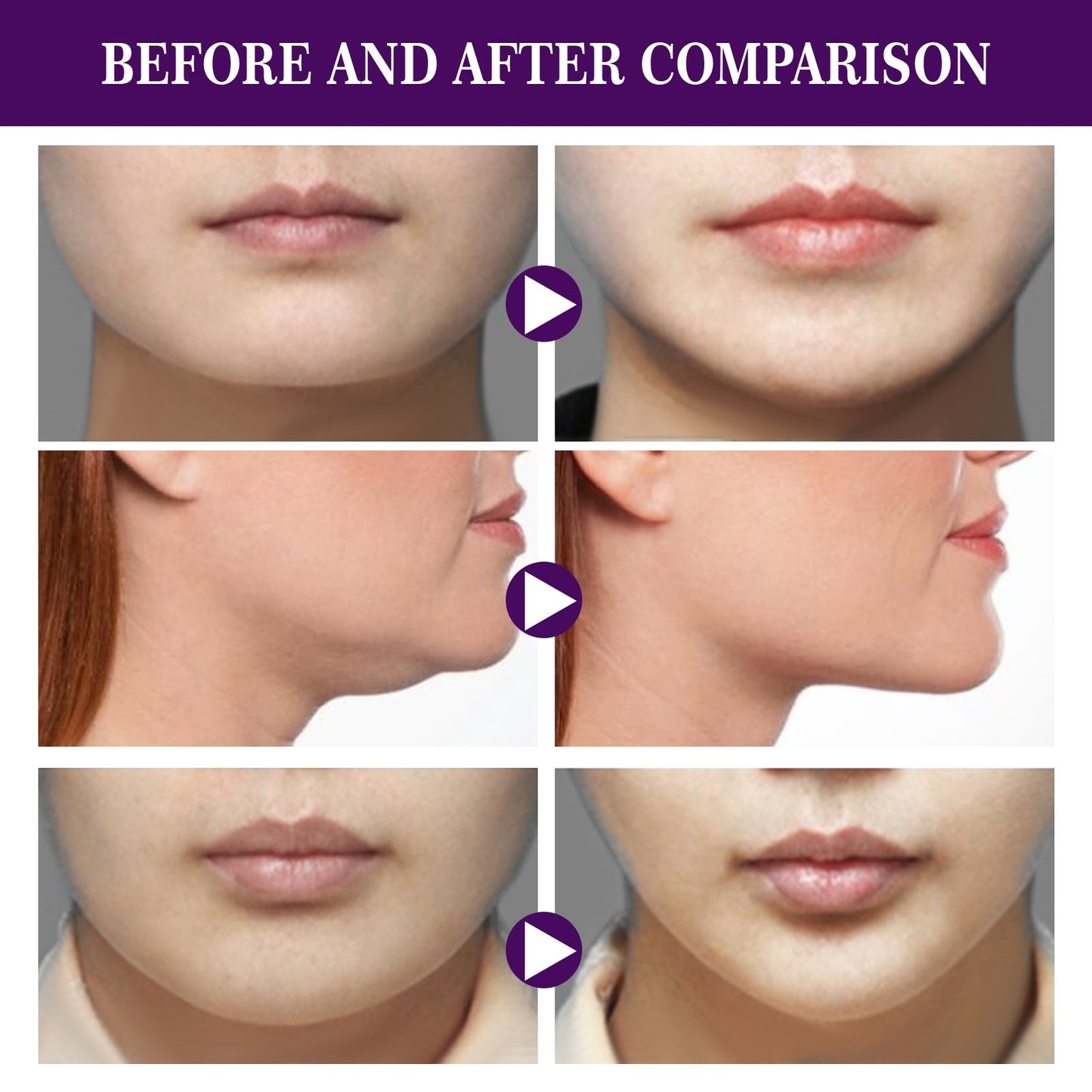 EELHOE Facial Lifting Patch Lift Double Chin and Define V Shaped Face