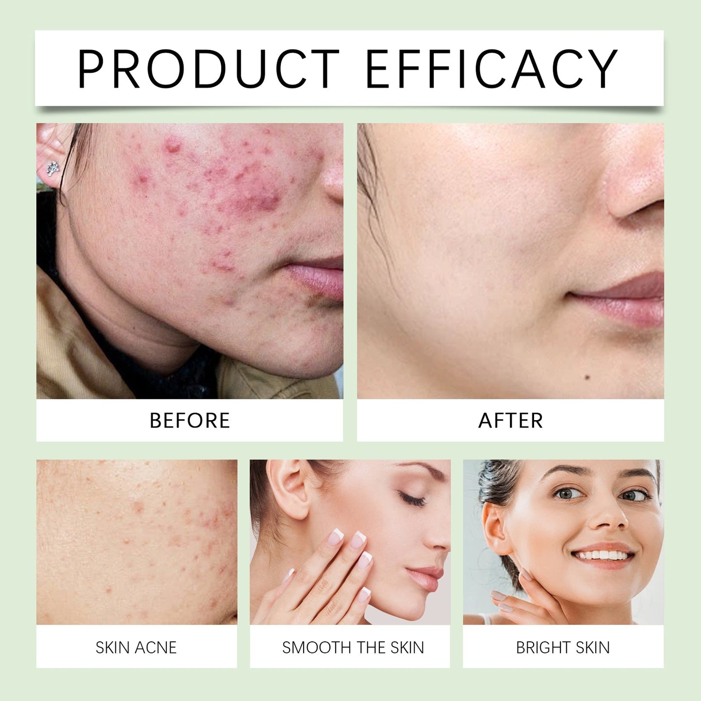 Viareline Salicylic Acid Facial Cleanser Deep Clean Refresh and Refine Pores