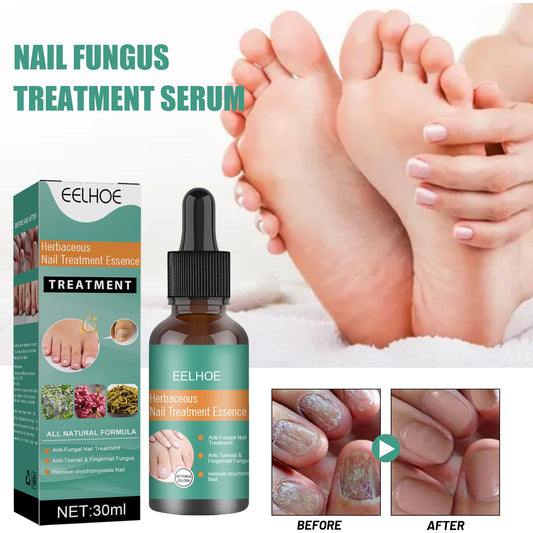 EELHOE Nail Repair Solution Strengthen and Restore Thick, Smooth and Healthy Nails