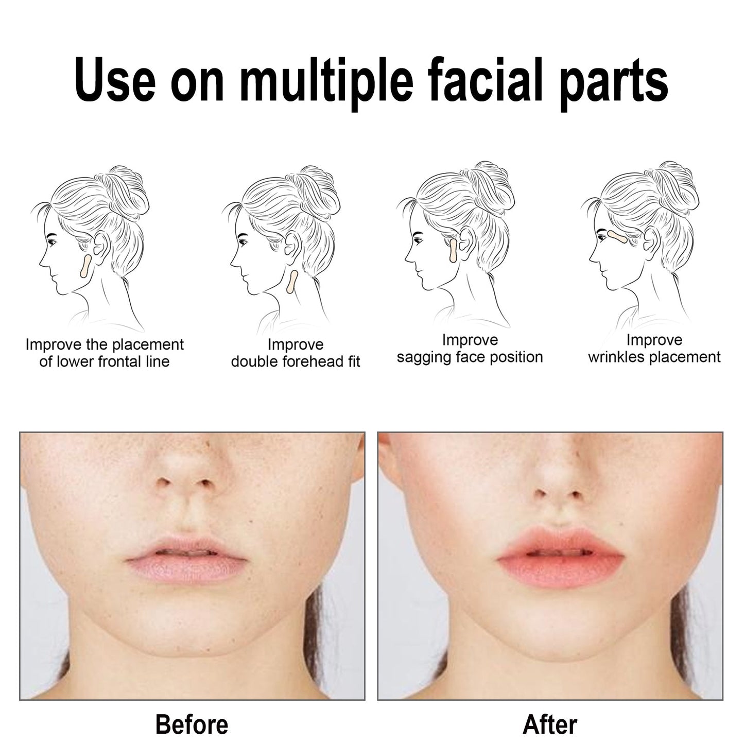 EELHOE Facial Lifting Patch Lift Double Chin and Define V Shaped Face