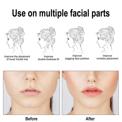 EELHOE Facial Lifting Patch Lift Double Chin and Define V Shaped Face